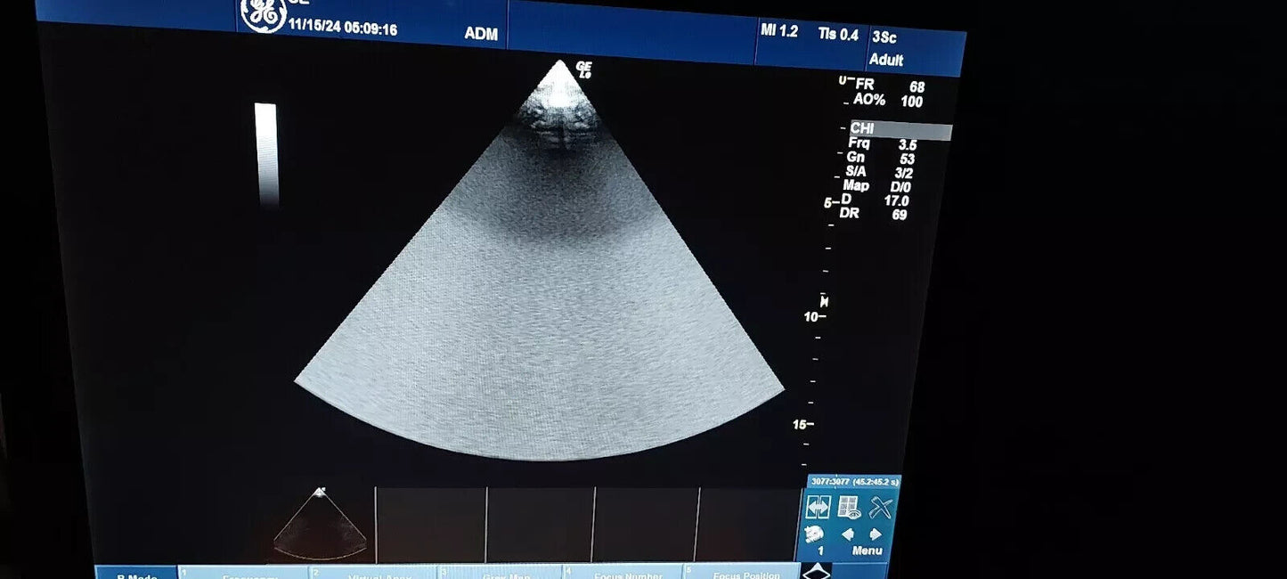 GE Ultrasound Probe  3Sc-RS  Transducer Tested Owkring General Electric 3Sc-RS